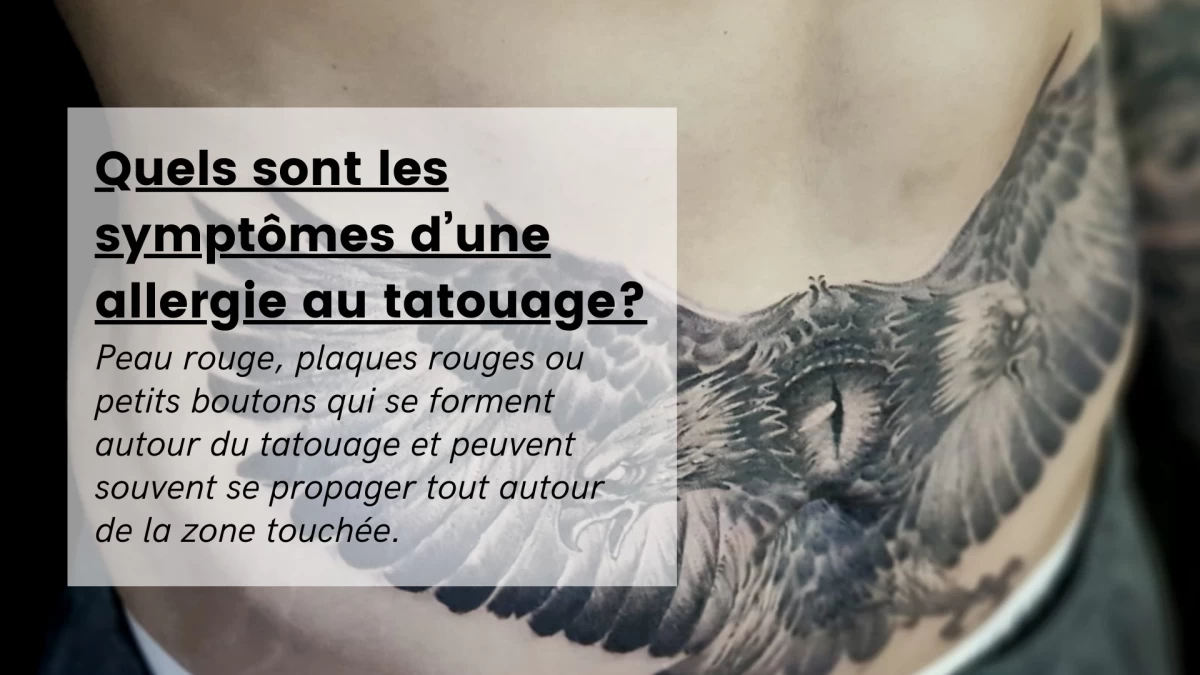 Quels sont les symptômes d’une allergie au tatouage