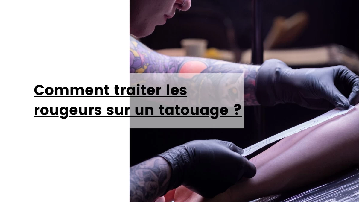 Comment traiter les rougeurs sur un tatouage