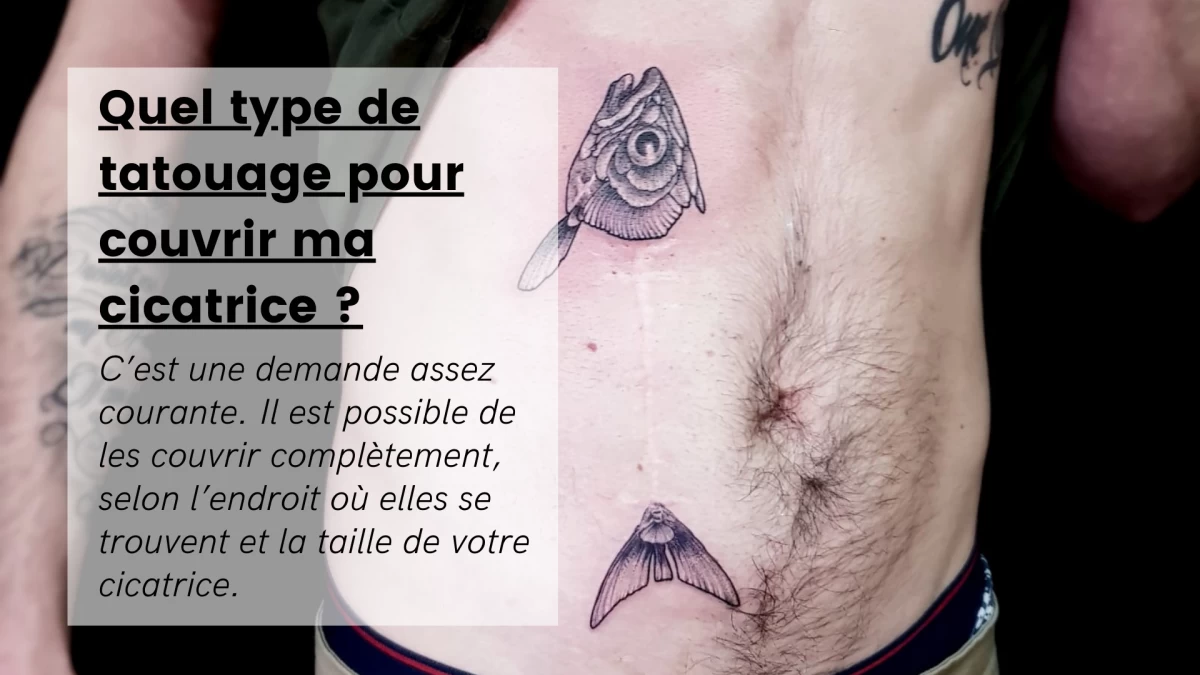 titre - Quel type de tatouage pour couvrir ma cicatrice