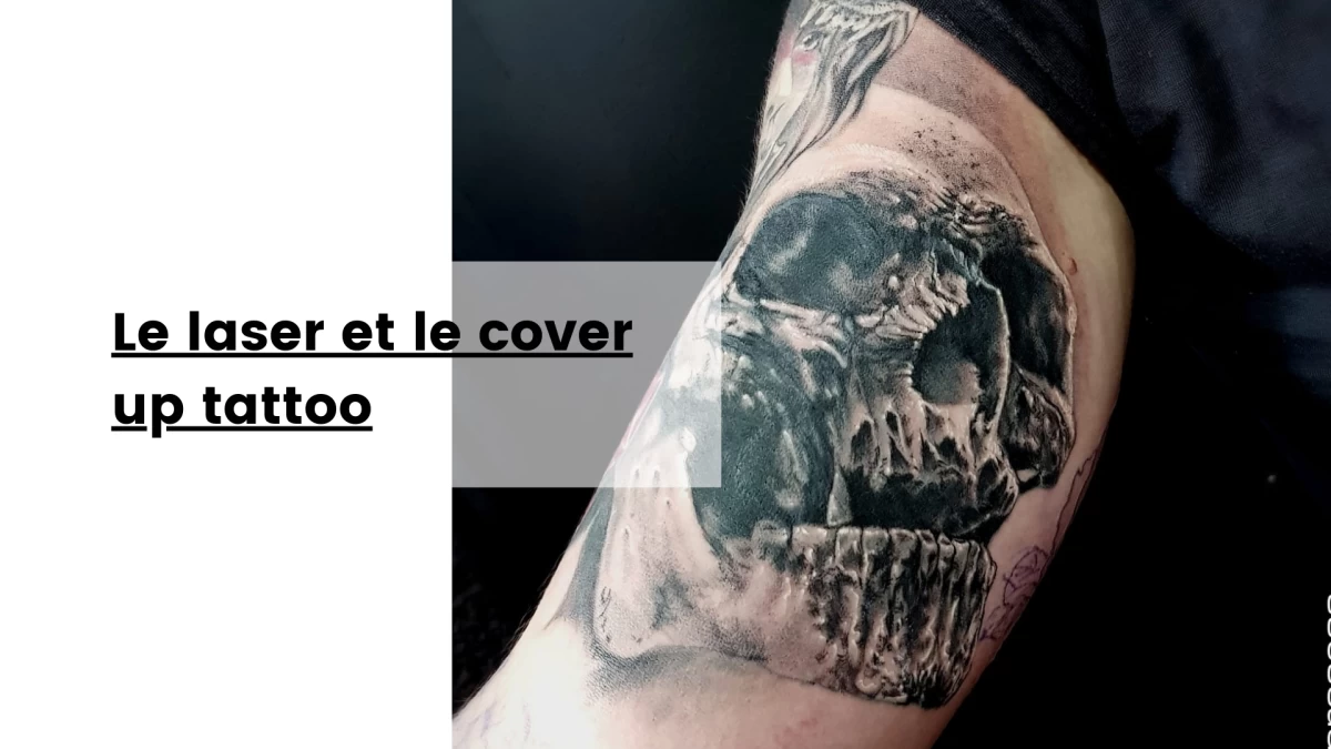 Le laser et le cover up tattoo