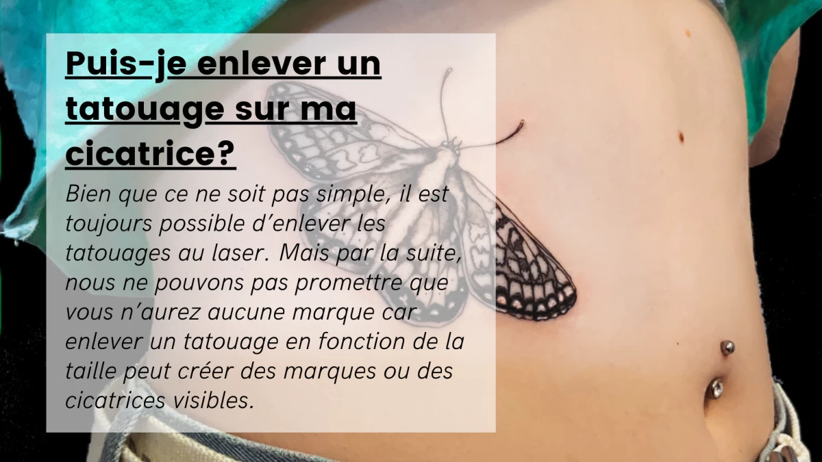 Puis-je enlever un tatouage sur ma cicatrice