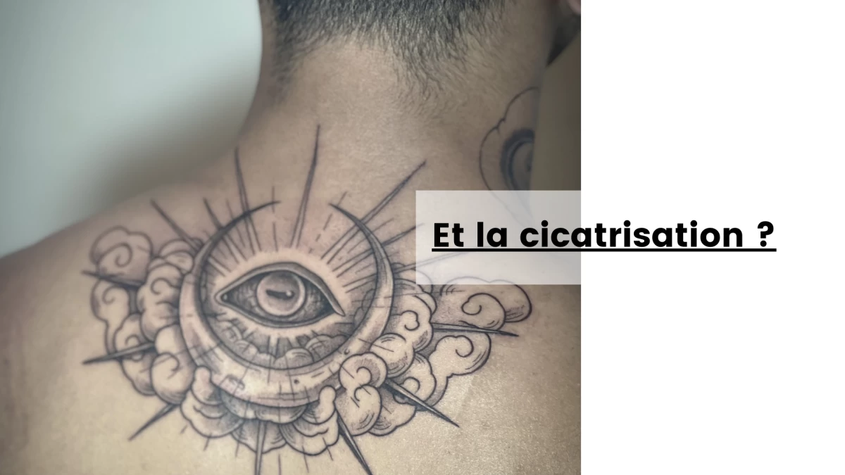 Et la cicatrisation
