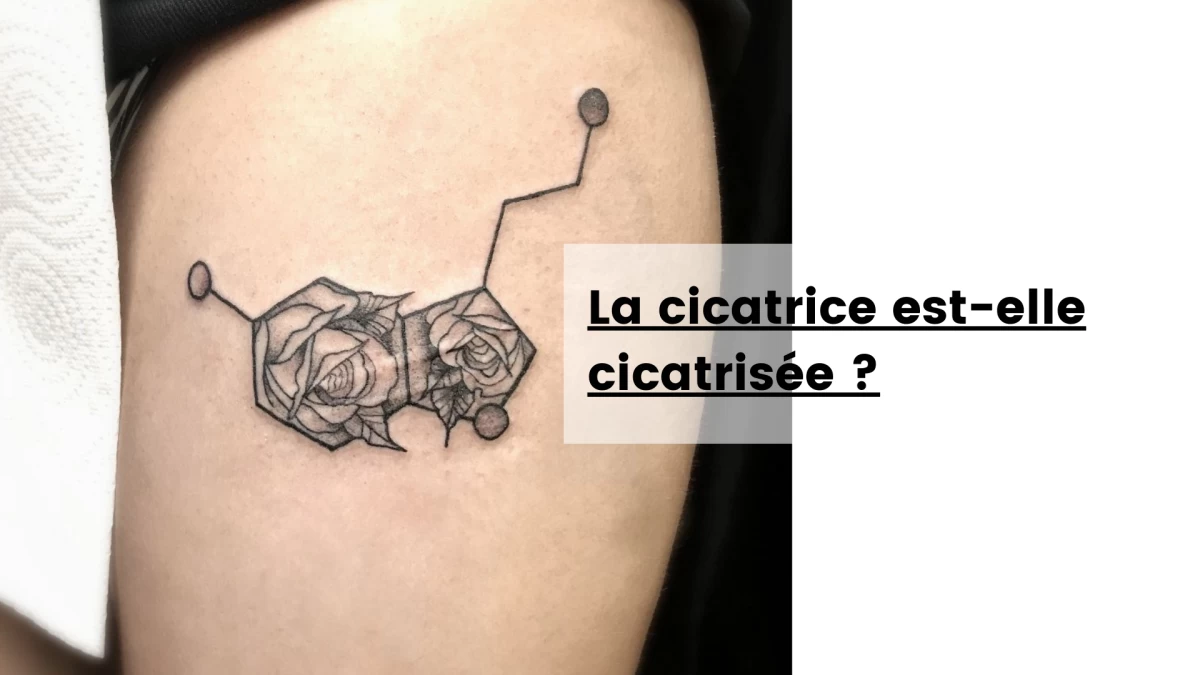 La cicatrice est-elle cicatrisée